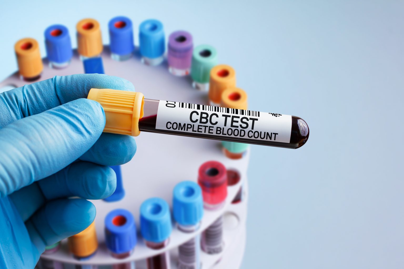 CBC Test Can Help You Understand Your Overall Health DLW