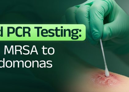 DNA PCR testing showing MRSA and Pseudomonas detection
