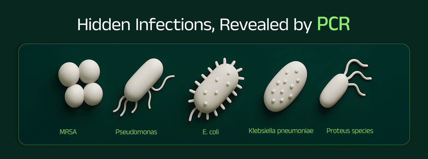 DNA PCR testing showing MRSA and Pseudomonas detection